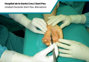 9º Master en Cirugía de la Mano y de la Extremidad Superior @ Barcelona