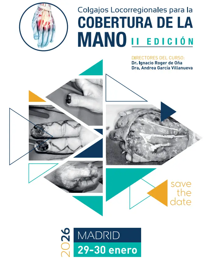 COLGAJOS LOCORREGIONALES PARA LA COBERTURA DE LA MANO II EDICIÓN